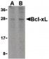 BCL2L1 / BCL-XL Antibody (C-Terminus)